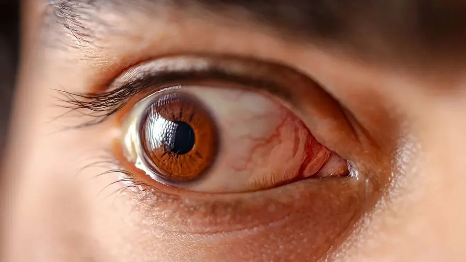 الصين تضع عيادة عيون تحت إدارة الذكاء الاصطناعي.. ماذا حدث؟ — China puts an eye clinic under artificial intelligence management – what happened?